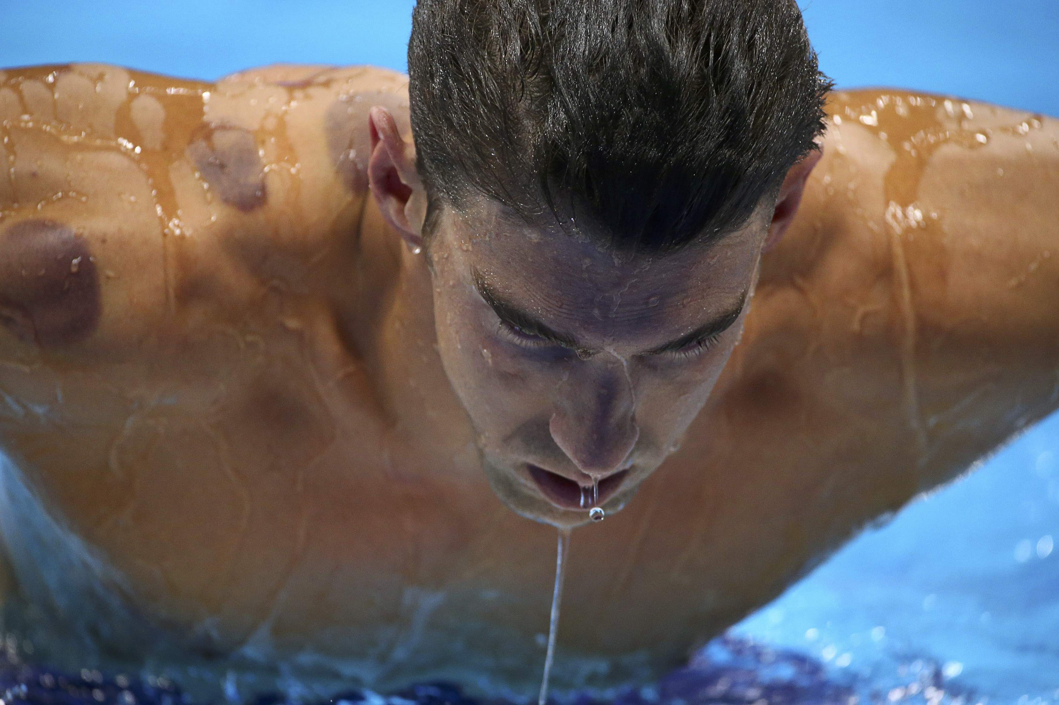 Κι οι βεντούζες του Φελπς κάτι σαν το ντόπινγκ κάνουν, λέει η ρωσική TV