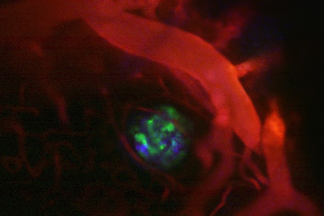 Πρώτες εικόνες των νευροδιαβιβαστών του εγκεφάλου εν δράσει