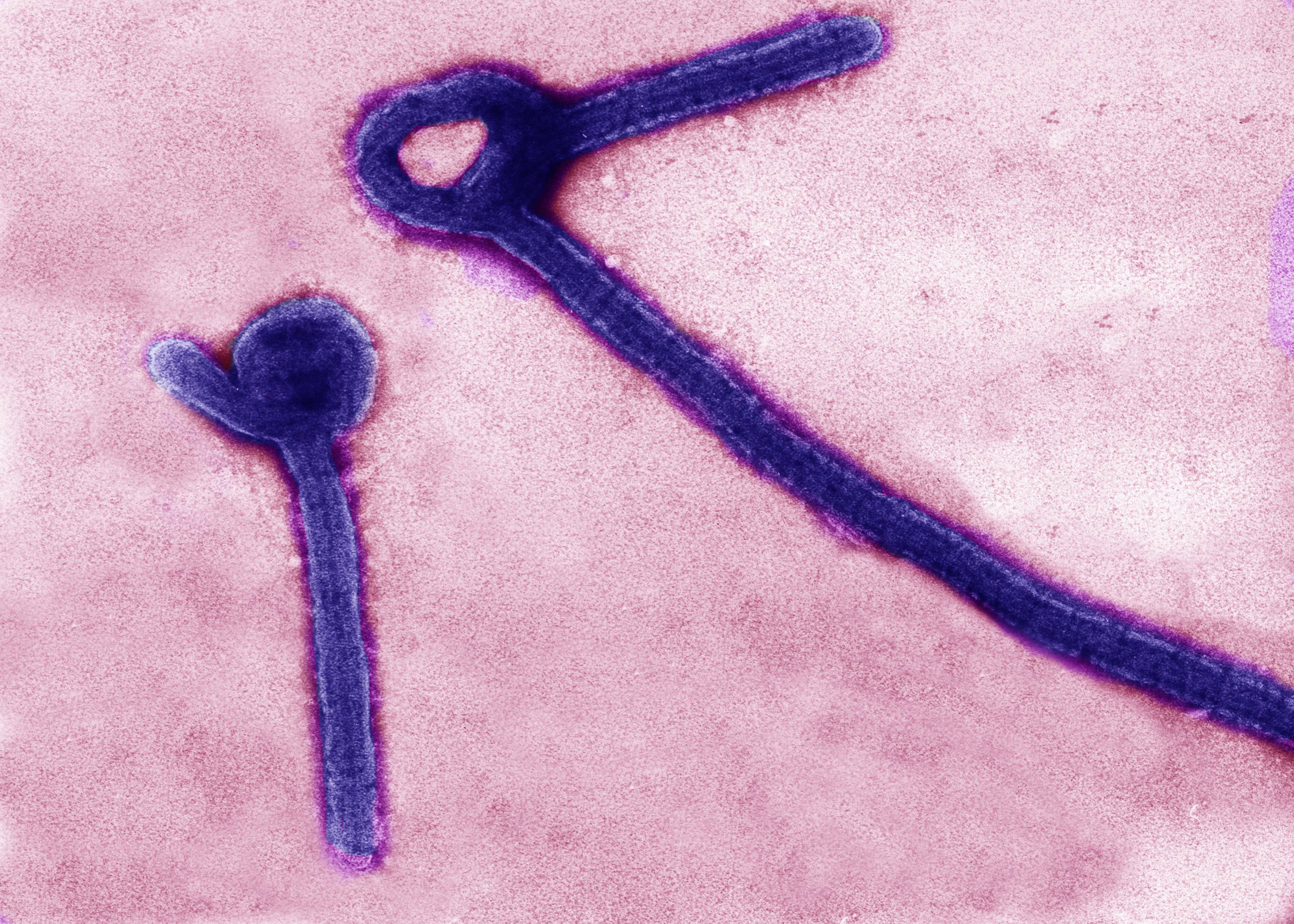 Μετάλλαξη κάνει τον ιό Έμπολα πιο επικίνδυνο για τους ανθρώπους