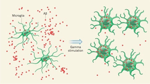 Θεραπεία της νόσου Αλτσχάιμερ με φωτισμό LED προτείνουν ερευνητές