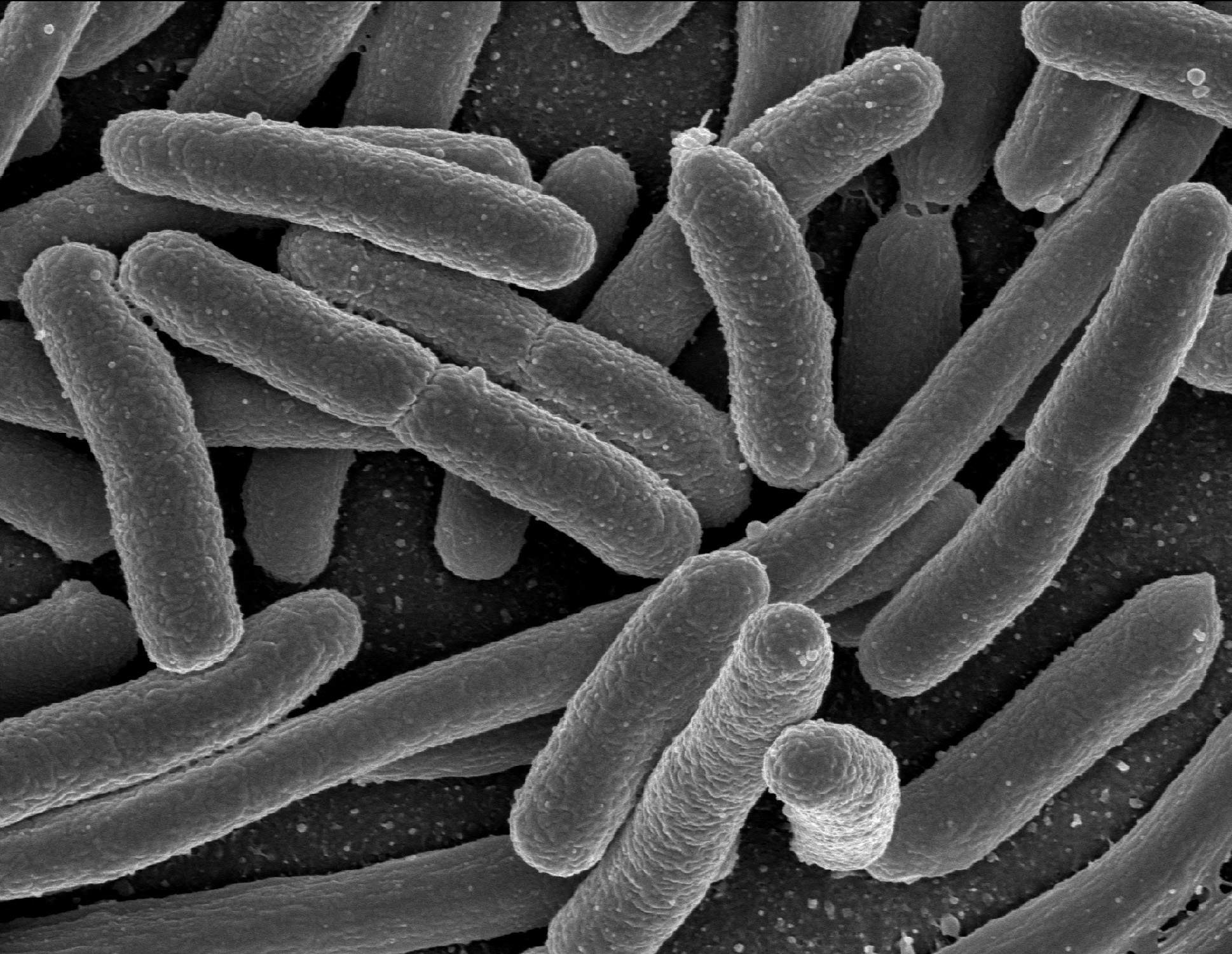 Καμπανάκι από τον ΠΟΥ για 12 οικογένειες πολυανθεκτικών βακτηρίων