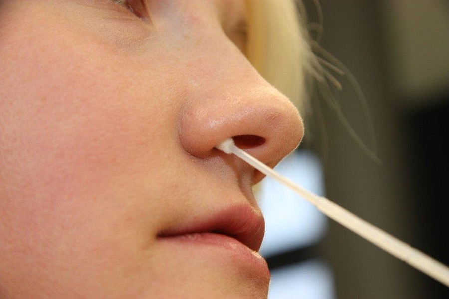 Ρινικός βιοδείκτης βοηθά στη διάγνωση του καρκίνου του πνεύμονα