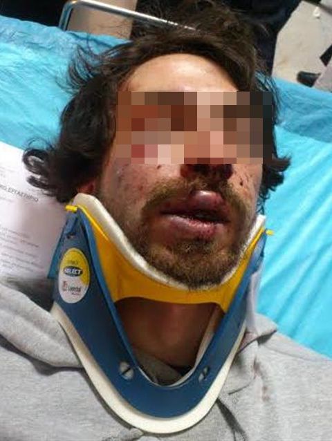 Αγριος ξυλοδαρμός φοιτητή πιθανόν από ομάδα χρυσαυγιτών