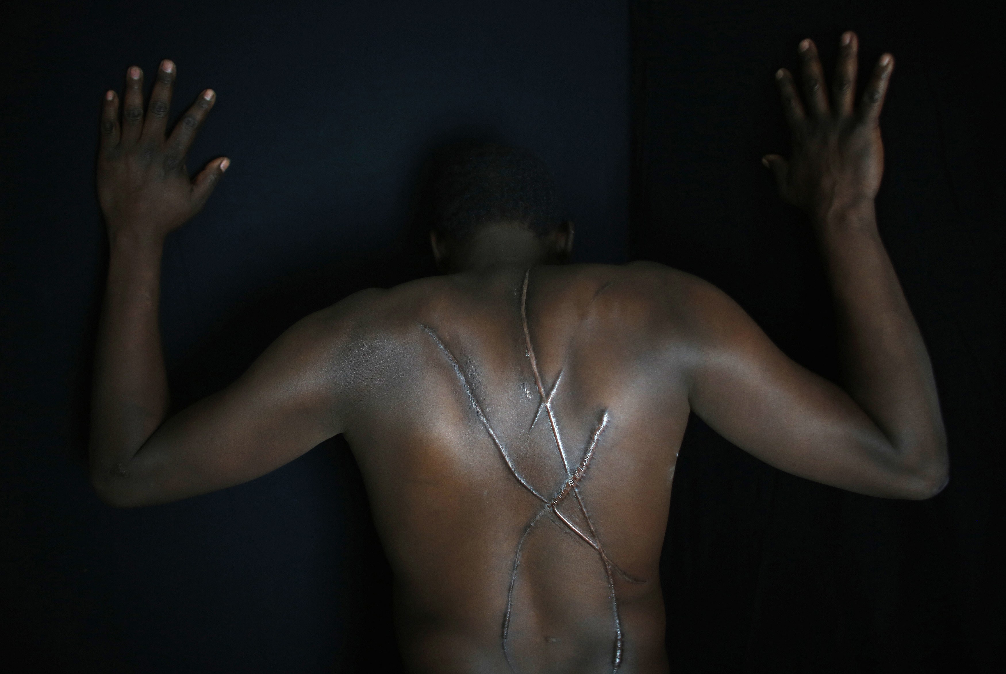 Αύξηση των σοβαρών επιθέσεων με ρατσιστικό κίνητρο το 2016