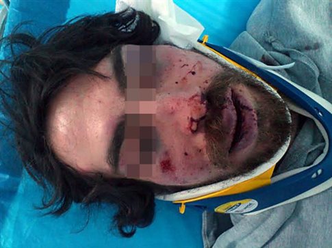 Απολογείται ο χρυσαυγίτης για τον άγριο ξυλοδαρμό του φοιτητή