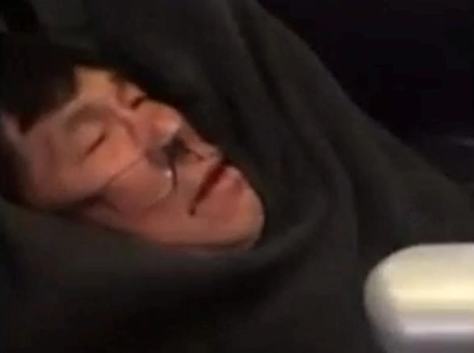 Συγγνώμη ζήτησε ο διευθυντής της United για τη βίαιη απομάκρυνση επιβάτη