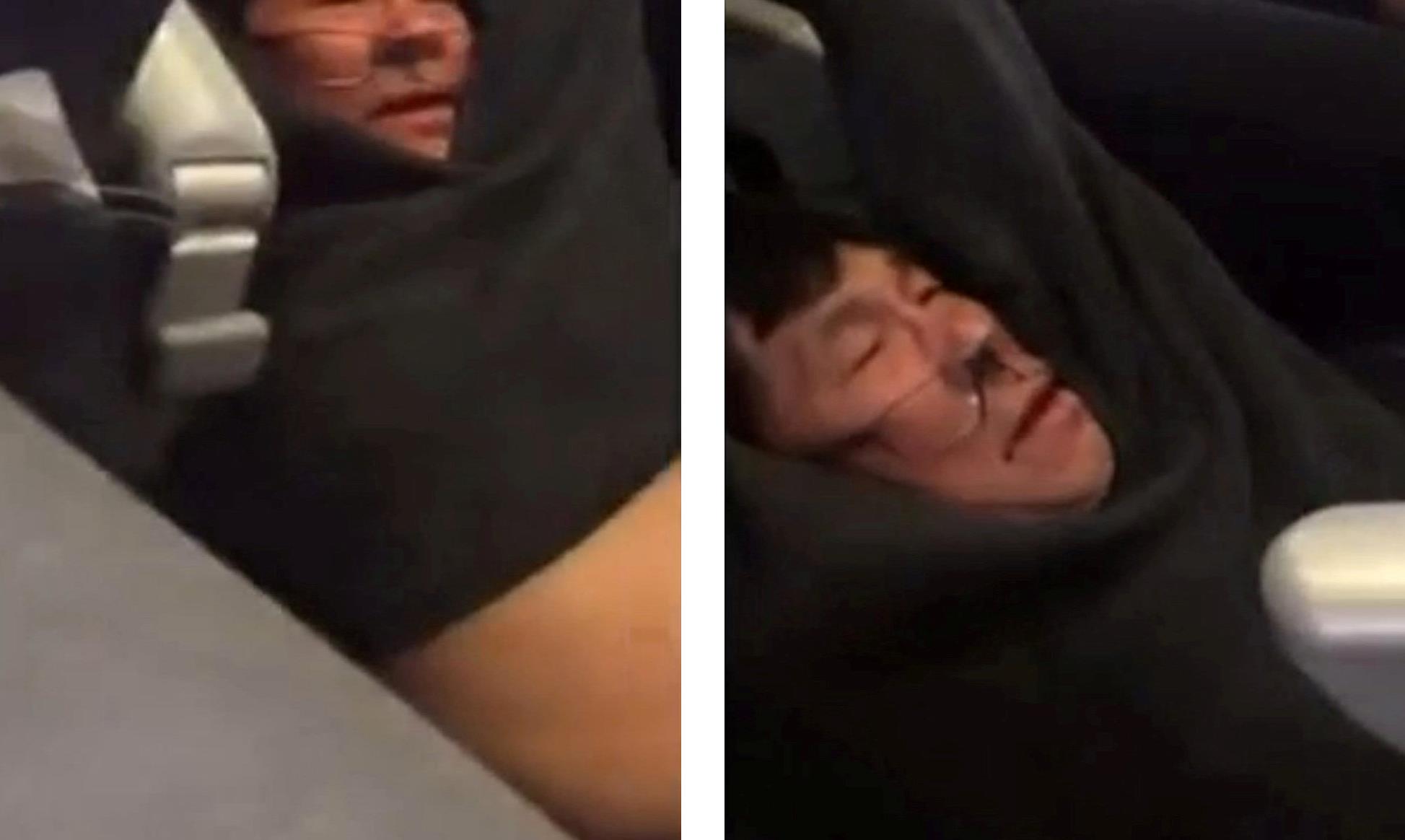 «Τα βρήκε» η United με τον επιβάτη που έβγαλαν από το αεροπλάνο σηκωτό