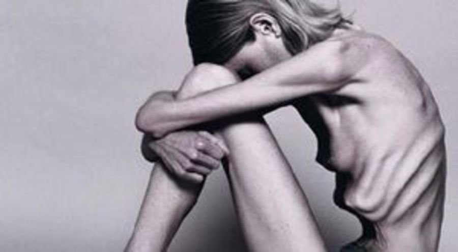 Εντοπίστηκε ο πρώτος γενετικός τόπος που σχετίζεται με την ανορεξία