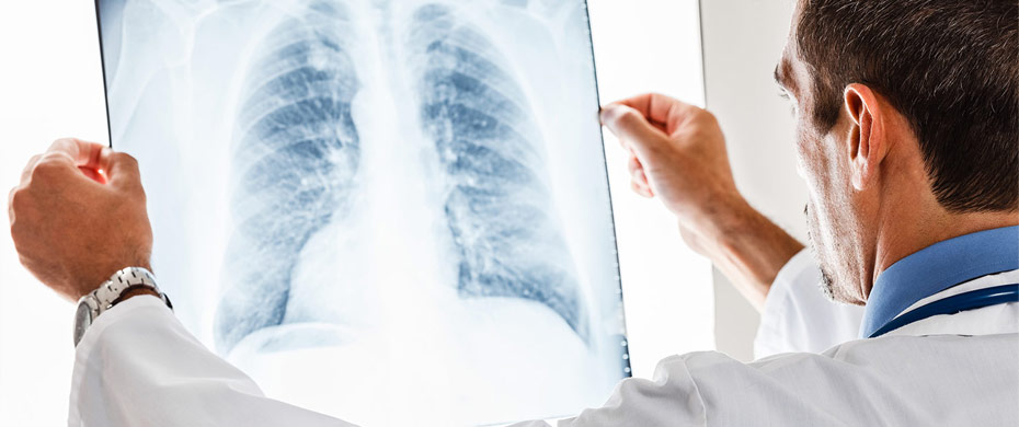 ΧΑΠ: Σημαντική η σωστή χρήση των συσκευών εισπνοής κατά τη θεραπεία