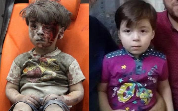 Η νέα ζωή του μικρού Ομράν που έγινε σύμβολο της φρίκης στο Χαλέπι