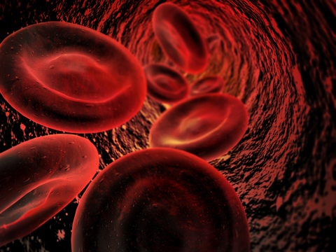 Το fitusiran μειώνει τις αιμορραγίες σε ασθενείς με Αιμορροφιλία Α και Β
