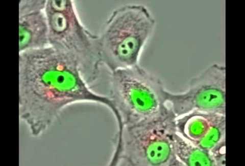 Κύτταρα «κανίβαλοι» μπορούν να εμποδίσουν την ανάπτυξη του καρκίνου