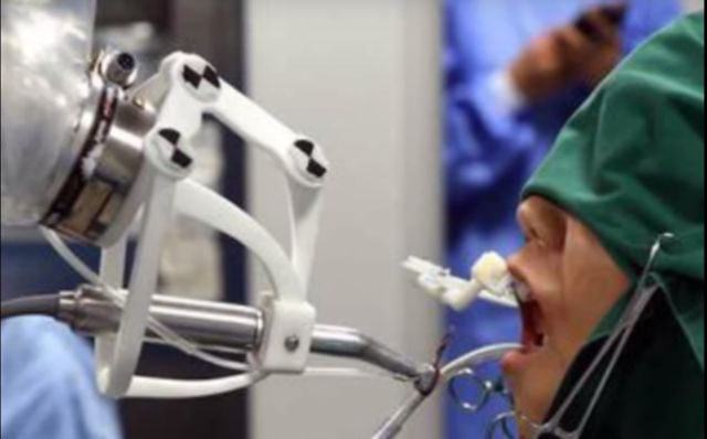 Τώρα τα ρομπότ έγιναν και οδοντίατροι [βίντεο]