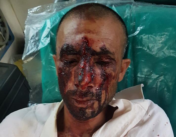 Ασπρόπυργος: 17χρονο ομογενή αναγνώρισε το θύμα της επίθεσης