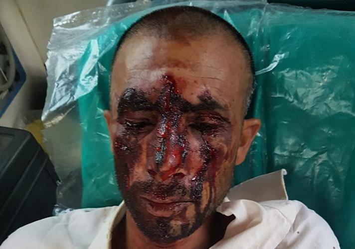 Εντοπίστηκαν οι δράστες της ρατσιστικής επίθεσης στον Ασπρόπυργο