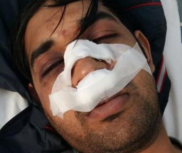 Και νέα ρατσιστική επίθεση κατά μετανάστη