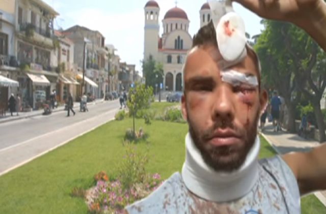 Άγριος ξυλοδαρμός 30χρονου φοιτητή στο Ρέθυμνο