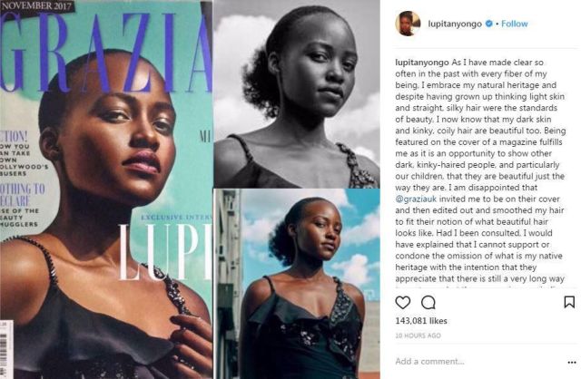 Νιόνγκο: Καταγγέλλει λογοκρισία «ευρωκεντρικής» ομορφιάς