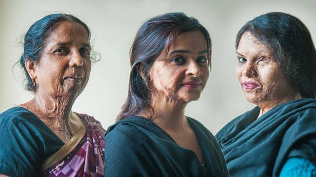 Ινδία: Γυναίκες που δέχθηκαν επίθεση με οξύ σε επίδειξη μόδας