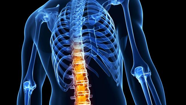 Φάρμακο σταματά την εξέλιξη της αγκυλοποιητικής σπονδυλαρθρίτιδας