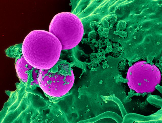 Παλαιό αντιβιοτικό σκοτώνει υπερβακτήρια μετά από… λίφτινγκ