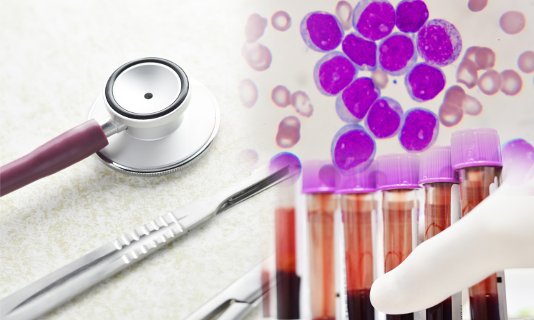 Συνδυαστική αγωγή βελτιώνει τη επιβίωση των ασθενών με ΧΛΛ