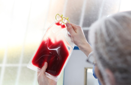 Ελληνική Ομοσπονδία Θαλασσαιμία: Λιγοστεύουν τα αποθέματα αίματος