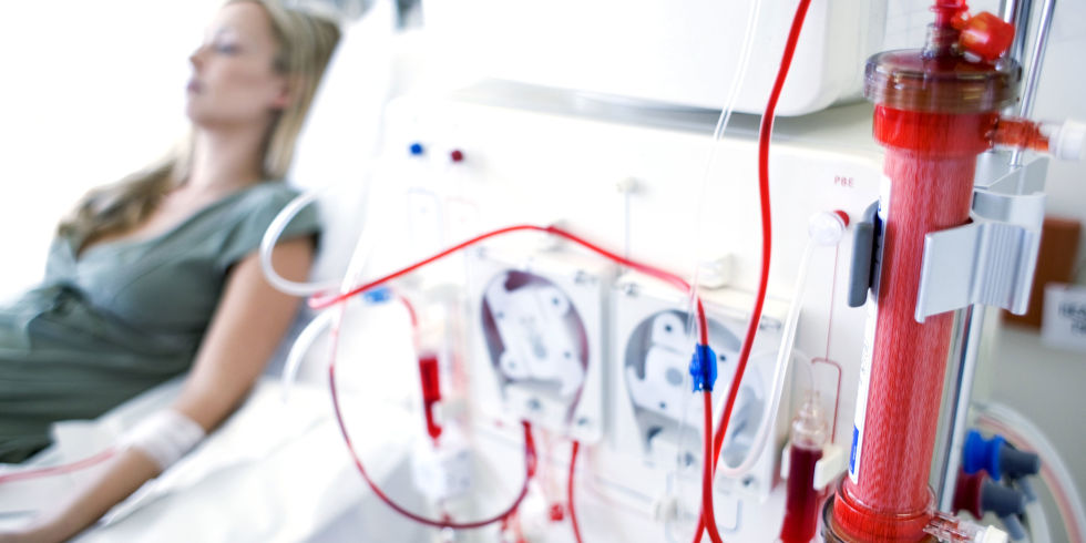 Αυξήθηκαν οι ασθενείς που κάνουν αιμοκάθαρση – Λίγες οι μεταμοσχεύσεις νεφρού