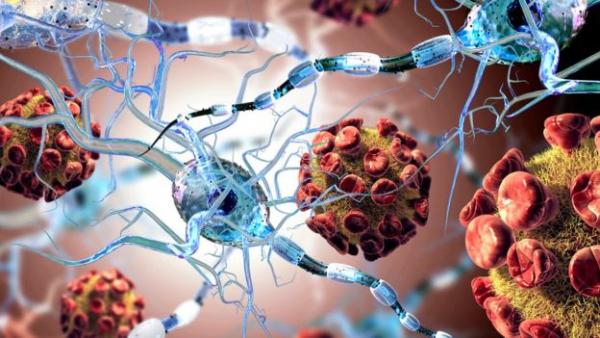 Μεταμόσχευση βλαστοκυττάρων αναχαιτίζει την πολλαπλή σκλήρυνση