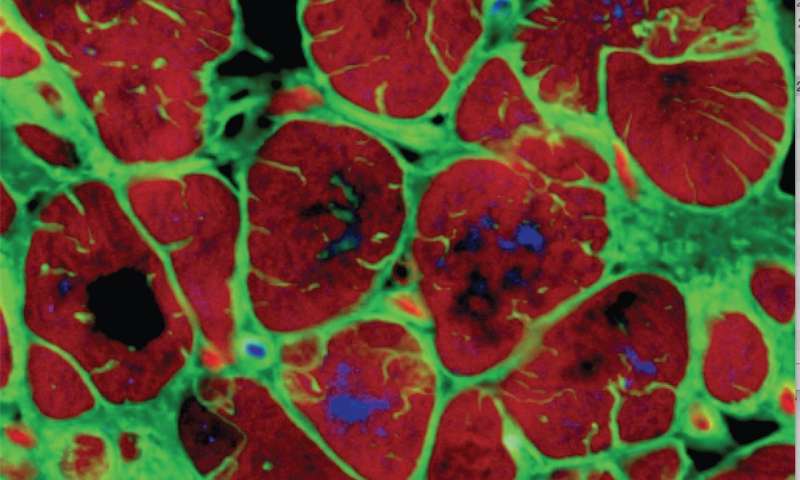 Ανεπτύχθη ώριμος ανθρώπινος καρδιακός μυς από βλαστοκύτταρα [Βίντεο]