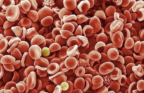 Πειραματική θεραπεία αλλάζει τα δεδομένα στη β-θαλασσαιμία