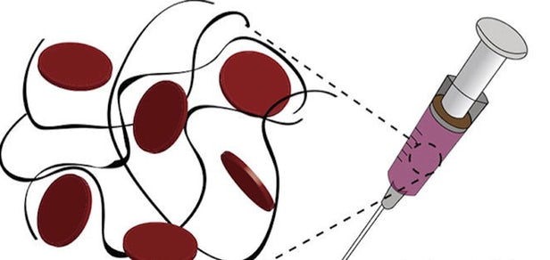 Ενέσιμος «επίδεσμος» σταματά την εσωτερική αιμορραγία στο λεπτό