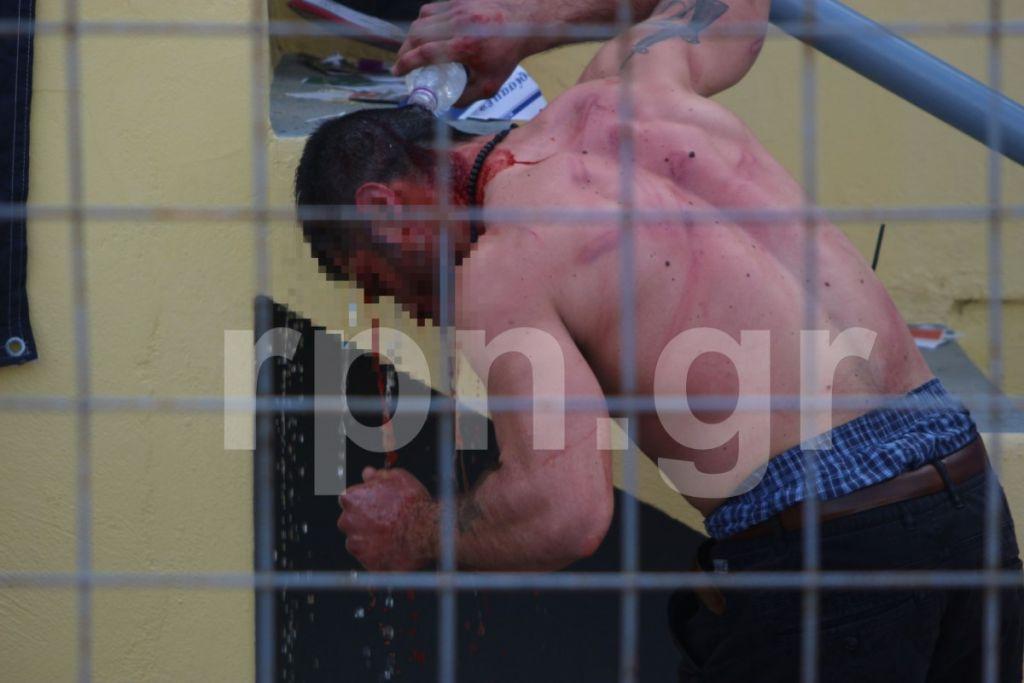 Άγρια συμπλοκή σε αγώνα της Γ’ Εθνικής