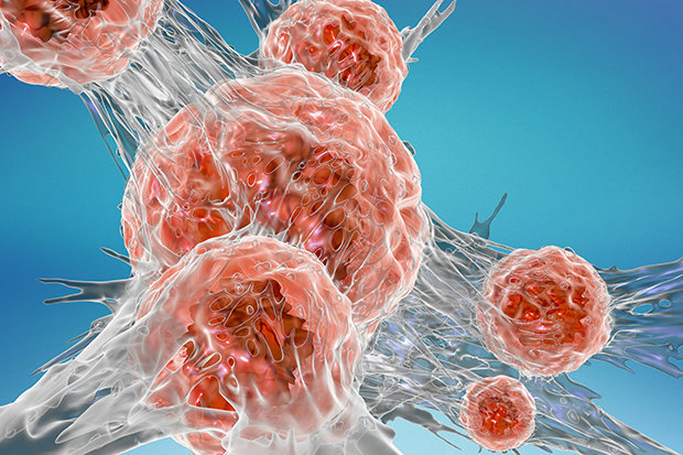 Μελέτη εξηγεί την πρώιμη καρκινική μετάσταση