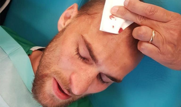 Ντοστ για την επίθεση από οπαδούς: Δεν έχω λόγια, είμαστε σοκαρισμένοι