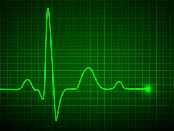 Η παχυσαρκία αυξάνει τον κίνδυνο καρδιακής αρρυθμίας