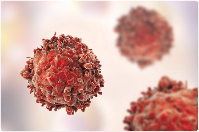 Επιστημονική ημερίδα για τον αιματολογικό καρκίνο