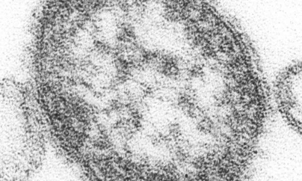 Φως στο μυστηριώδη ιό της ιλαράς ρίχνει νέα έρευνα