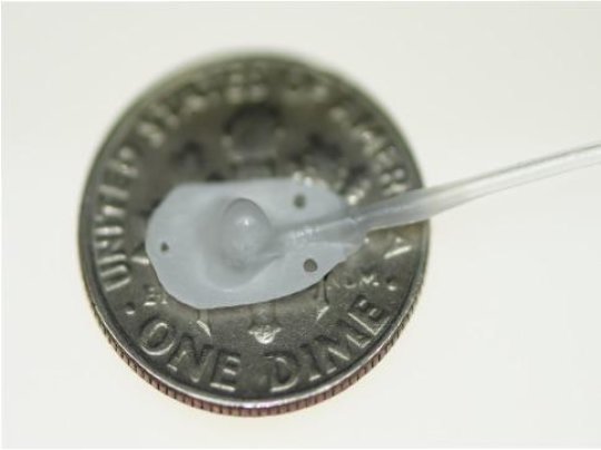 Εμφυτεύσιμη μικροσυσκευή προστατεύει την καρδιά μετά το έμφραγμα