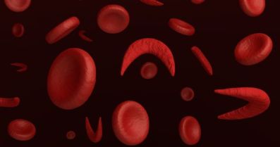 Όσα πρέπει να γνωρίζουμε για τη Δρεπανοκυτταρική Νόσο