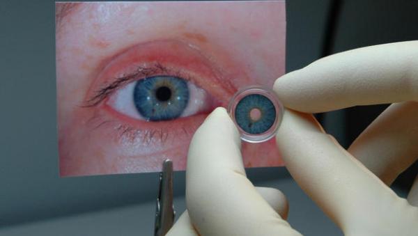 Τεχνητή συσκευή αντικαθιστά την ίριδα του ματιού