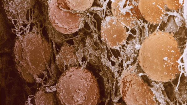 Ο φαιός λιπώδης ιστός στη μάχη κατά της παχυσαρκίας