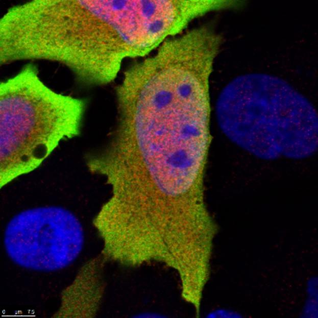 Ανακαλύφθηκε γονίδιο που «κρύβει» τα μυστήρια της ανοσίας