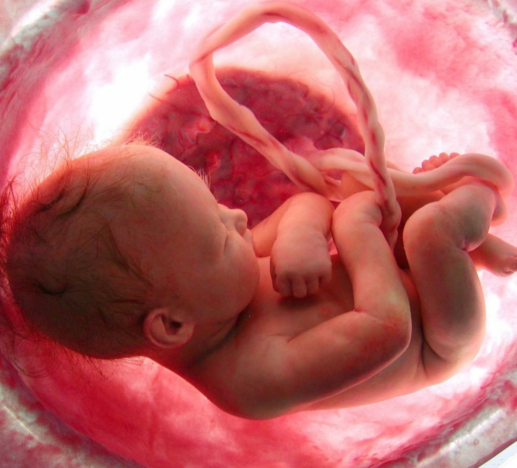 Το φύλο του εμβρύου παίζει ρόλο σε επιπλοκές της κύησης