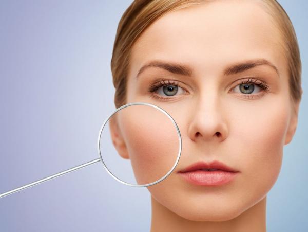 Δέκα τρόποι να προστατεύσετε το πρόσωπό σας από τις ευρυαγγείες