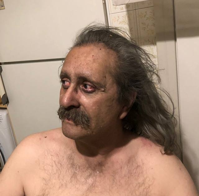 Συγκλονιστική ανάρτηση τυφλού επιζήσαντα από τον πύρινο εφιάλτη