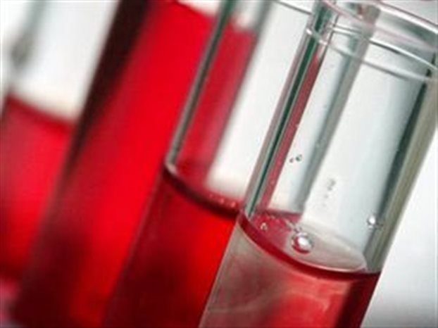 Νέα μέθοδος για την έγκαιρη διάγνωση του μυελώματος με εξέταση αίματος