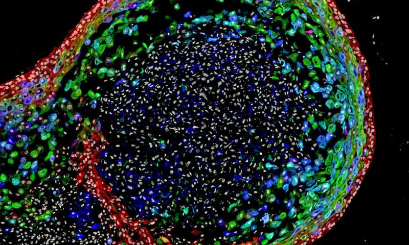 Ερευνητές δημιούργησαν ανθρώπινο οισοφάγο στο εργαστήριο