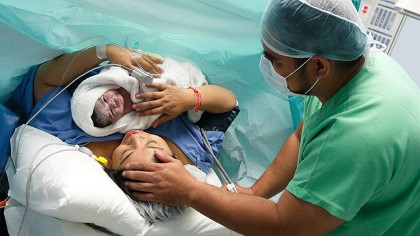 Ένα στα πέντε μωρά στον κόσμο γεννιούνται με καισαρική