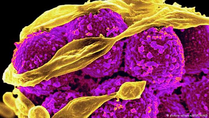 Τα ανθεκτικά μικρόβια αιτία θανάτου